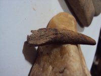 牙齿